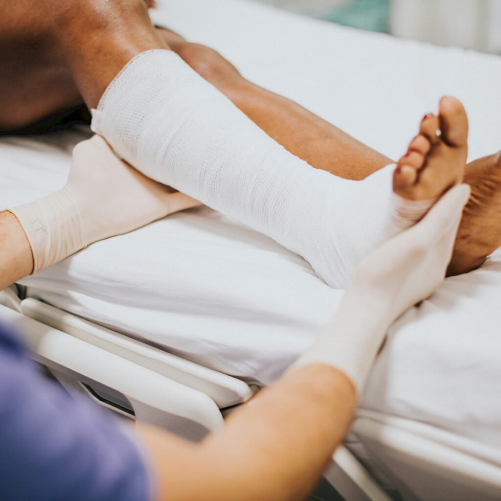 fracture